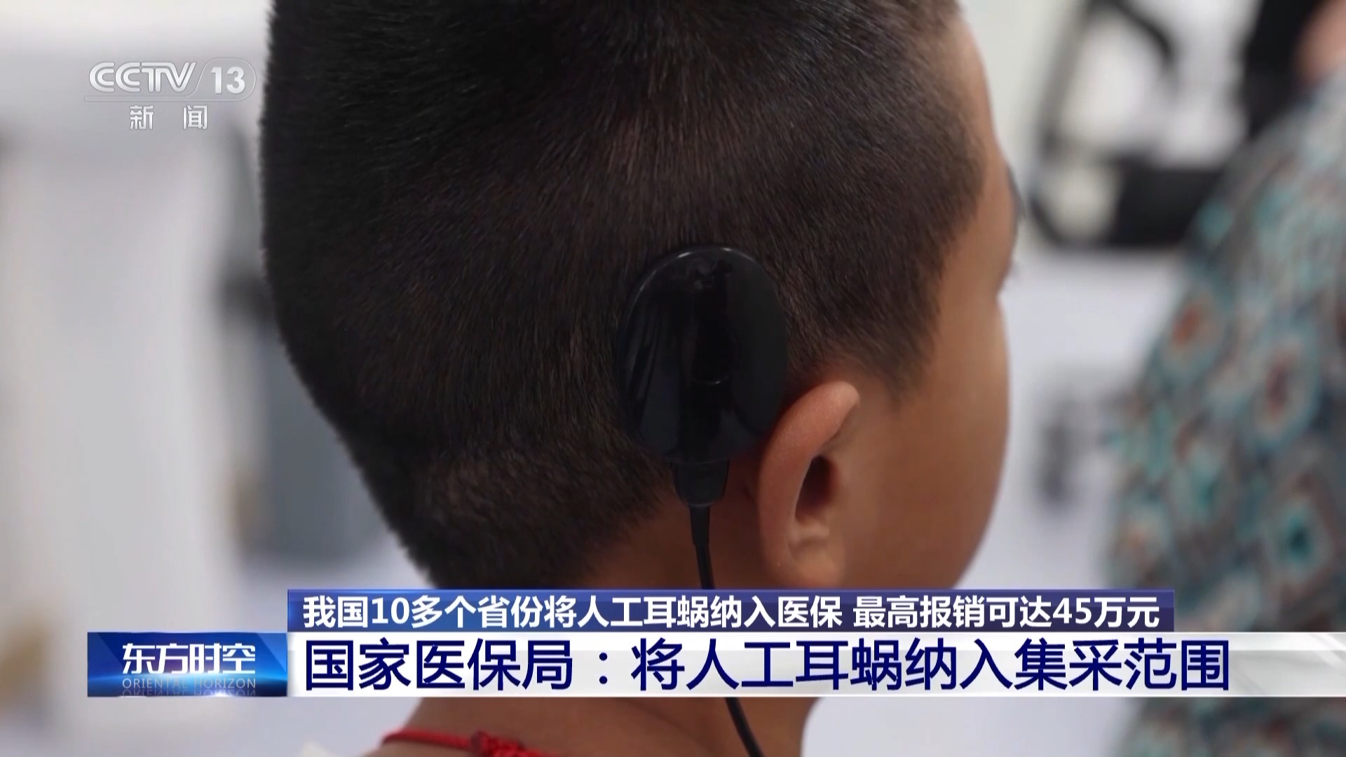 耳蜗需要做手术吗？