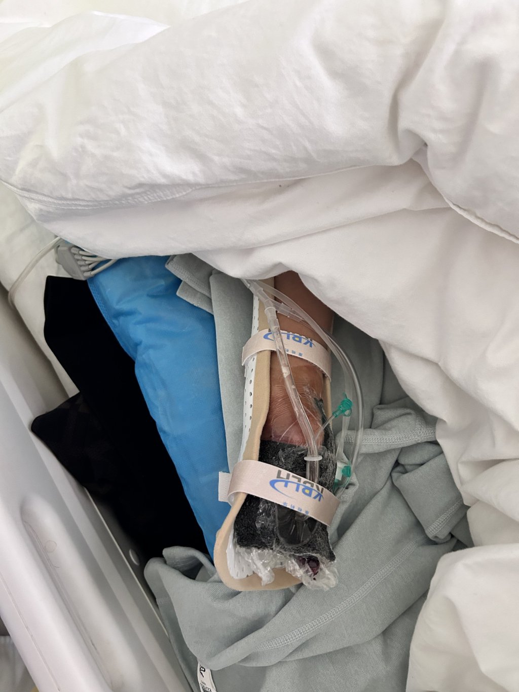 小夢正在醫院接受治療