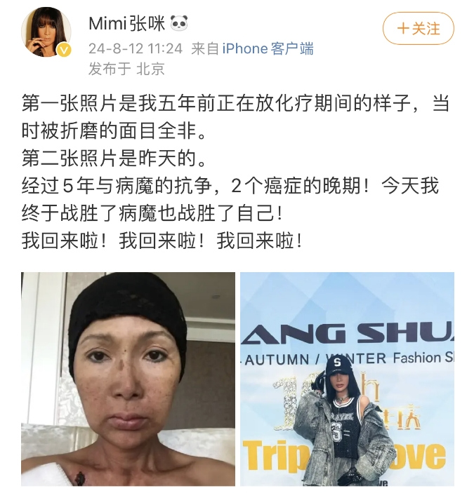 张咪晒出5年前放化疗时的照片。