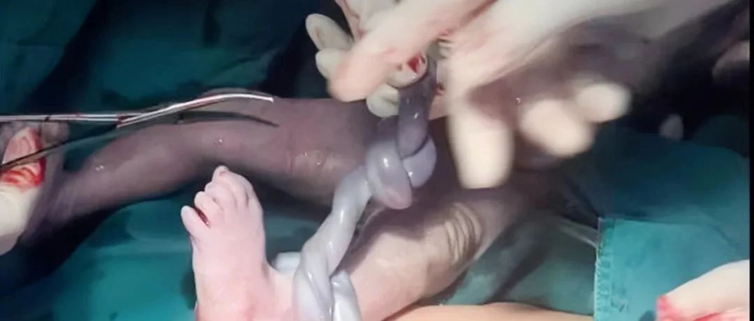 “这娃命真大！”一个“意外”差点断送宝宝生机