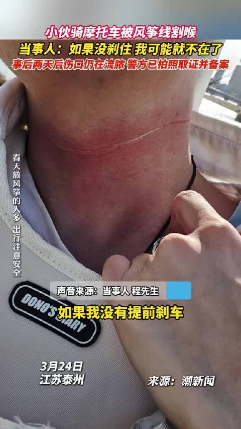 小伙骑摩托车被风筝线割喉 当事人：如果没刹住， 我可能就不在了…