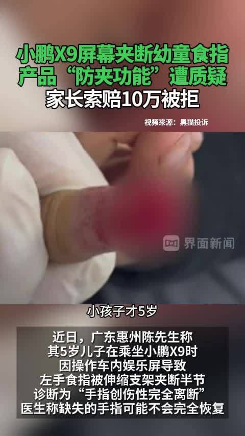 小鹏X9屏幕夹断幼童食指 ，产品“防夹功能”遭质疑，家长索赔10万被拒