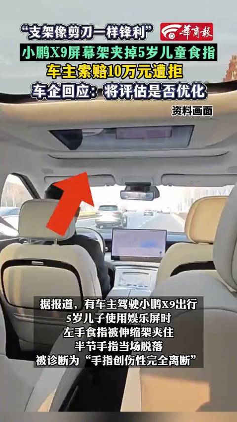 小鹏X9屏幕夹断5岁男童半节食指