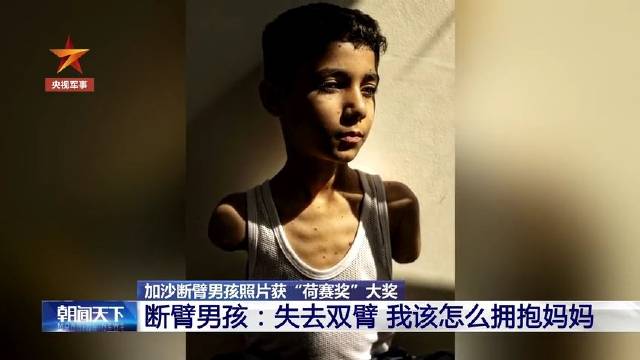 加沙断臂男孩
