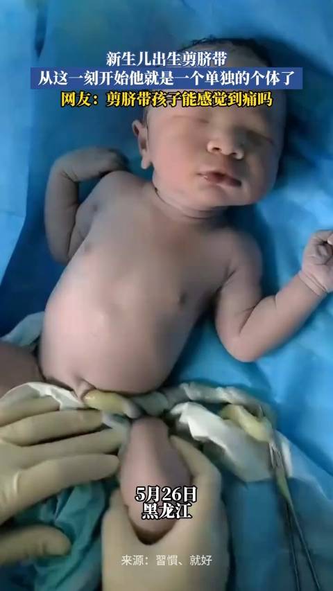 新生儿出生剪脐带，从这一刻开始他就是一个单独的个体了