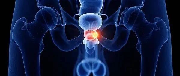 老戏骨靠注射女性荷尔蒙治疗前列腺癌？专家释疑