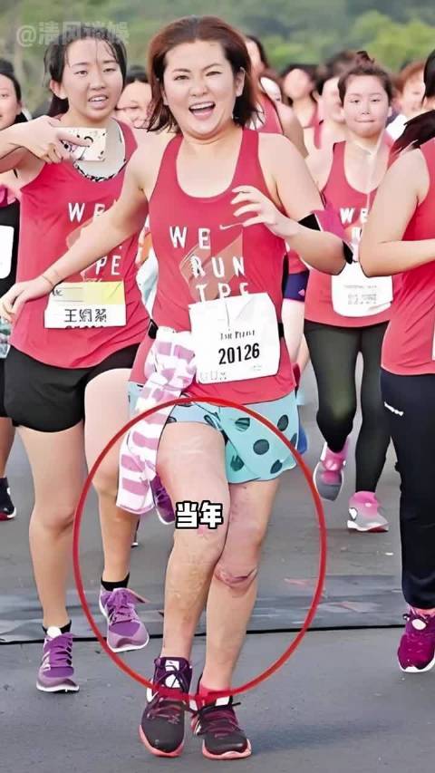 俞灏明2010年因爆破戏毁容，现状引关注