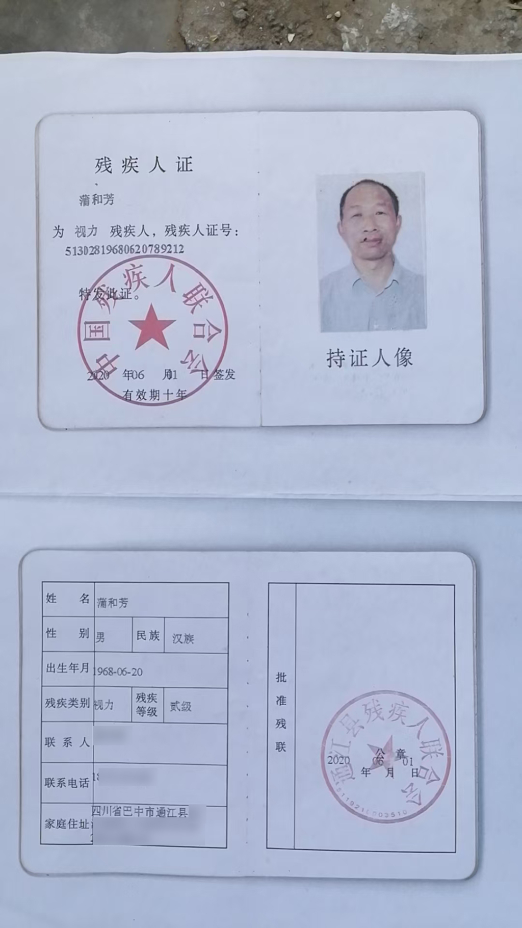 什么情况可以申请残疾证 177b-bd65fb1b4031db71d4bbf7a85cafa9b6.jpg