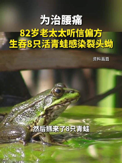 老人治腰疼活吞8只青蛙感染寄生虫