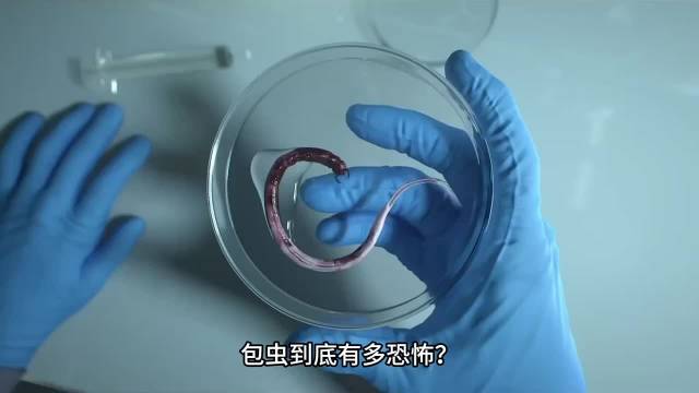 最让人绝望的寄生虫，包虫到底有多么恐怖？