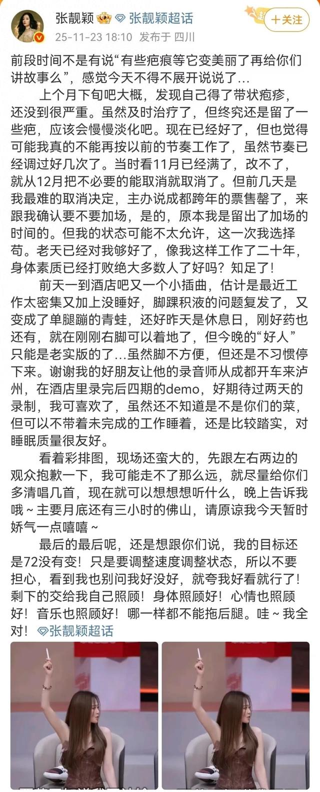 张靓颖透露患带状疱疹：虽及时治疗，还是留疤，“变成单腿蹦的青蛙”