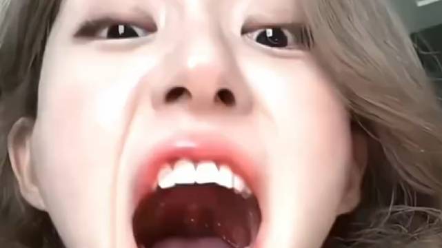 思露妍 当露露被粉丝问看扁桃体时