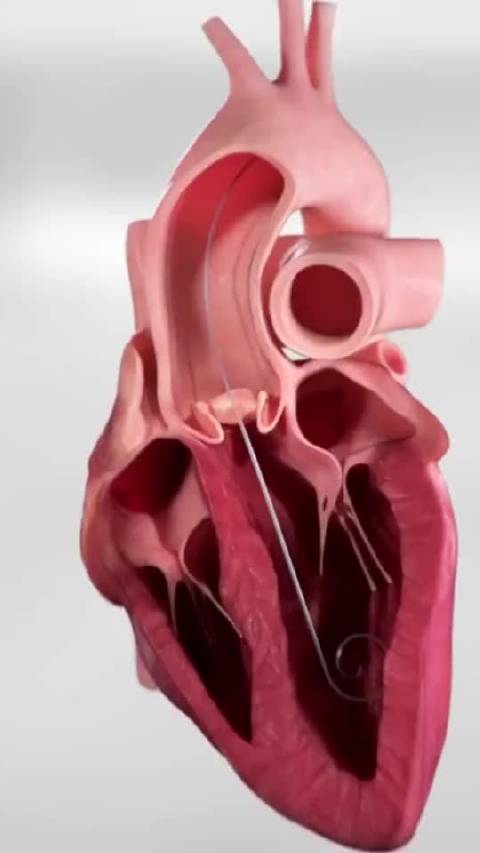 医院通报61万心脏瓣膜手术费用引关注