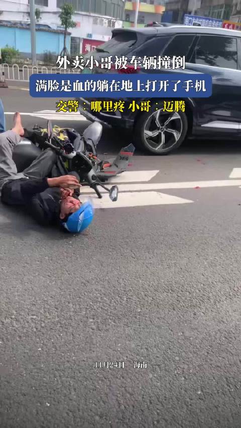 外卖小哥被车辆撞倒，满脸是血的躺在地上打开了手机，交警∶哪里疼 小哥∶迈腾