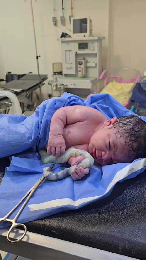 新生儿紧握脐带瞬间引关注