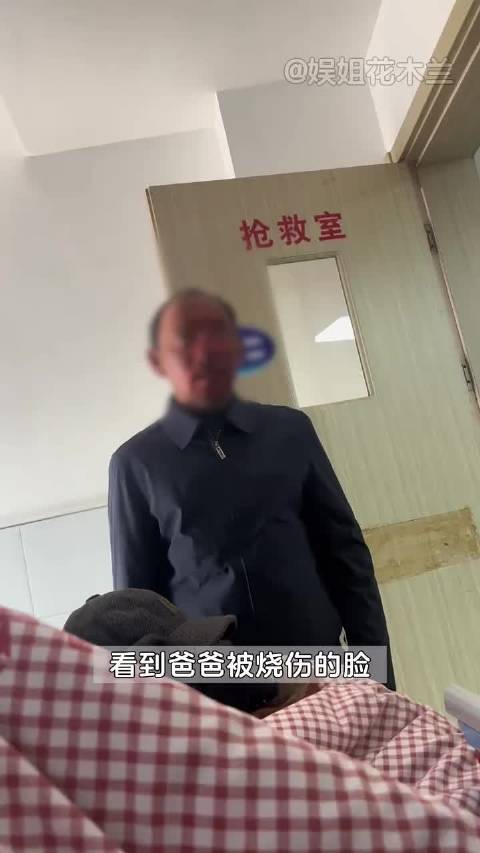 女儿目睹父亲烧伤面容泪崩