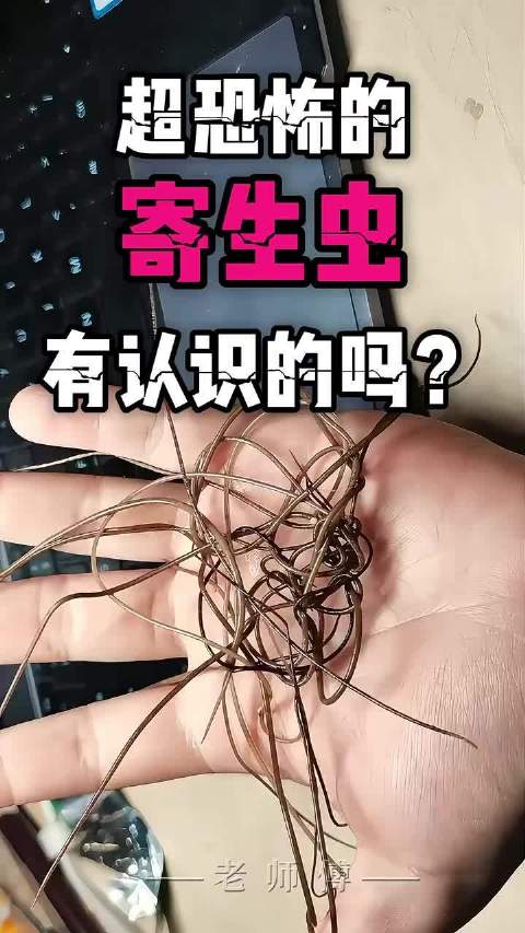 诡异寄生虫藏身潮湿角落，寄生爆发才现症状