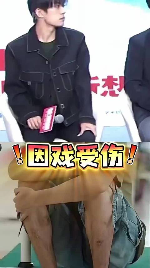 为何摄影师对易烊千玺“下半身”避之不及？