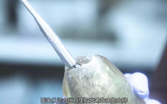 小伙为了治疗癌症竟然放入寄生虫去啃咬体内的病毒