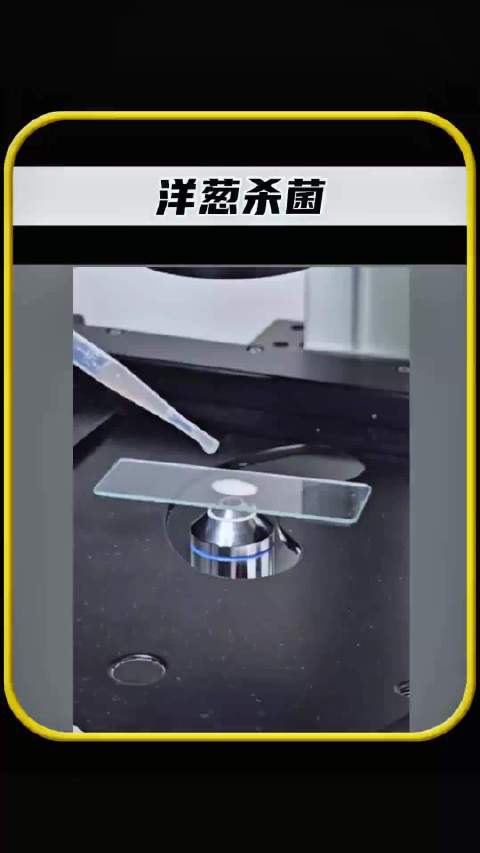 生吃洋葱无法杀灭寄生虫，医生建议及时就医用药