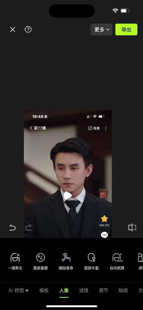 网友称叔叔神似黎明演技如梁朝伟，医美后将超越短帅一