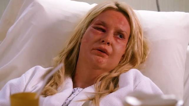 伊迪和苏珊打起来，伊迪被黄蜂蛰得好惨！