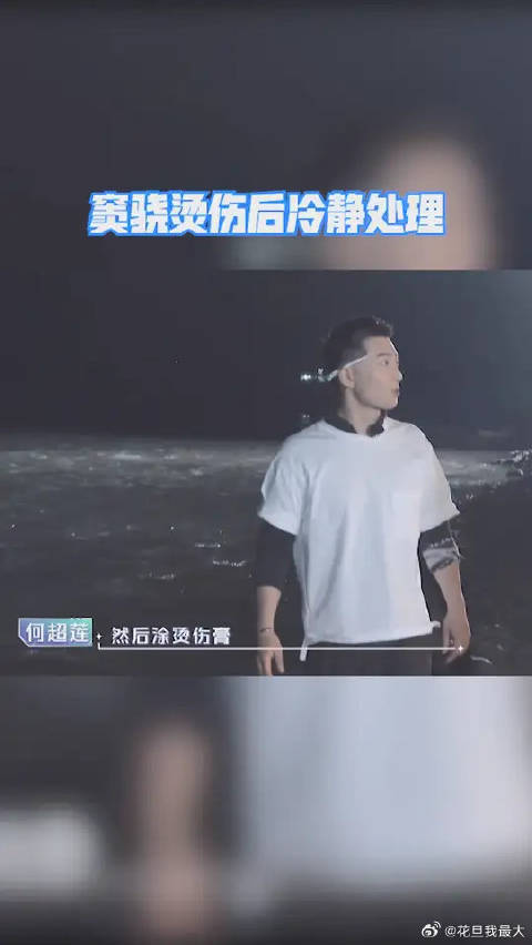 窦骁意外被烫伤，何超莲紧张到不行，窦骁烫伤后冷静处理的样子不错哦