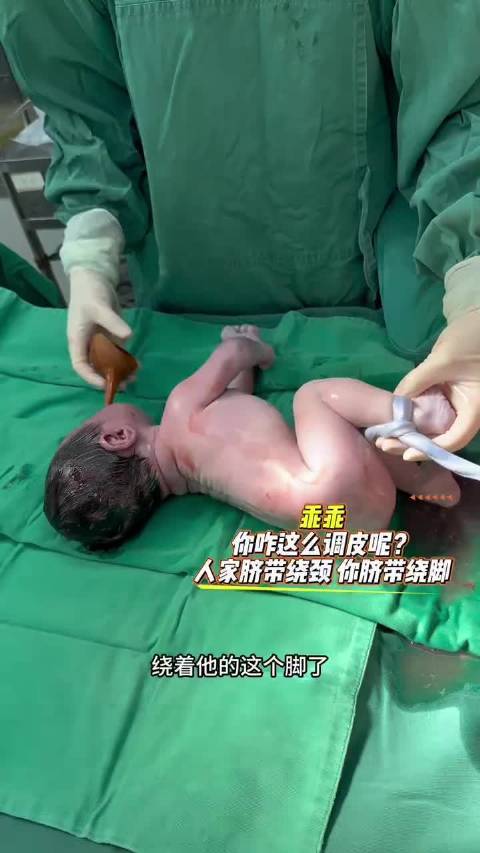 乖乖，你咋那么调皮呢？人家都是脐带绕颈，你来个脐带绕脚，给阿姨都吓坏了！