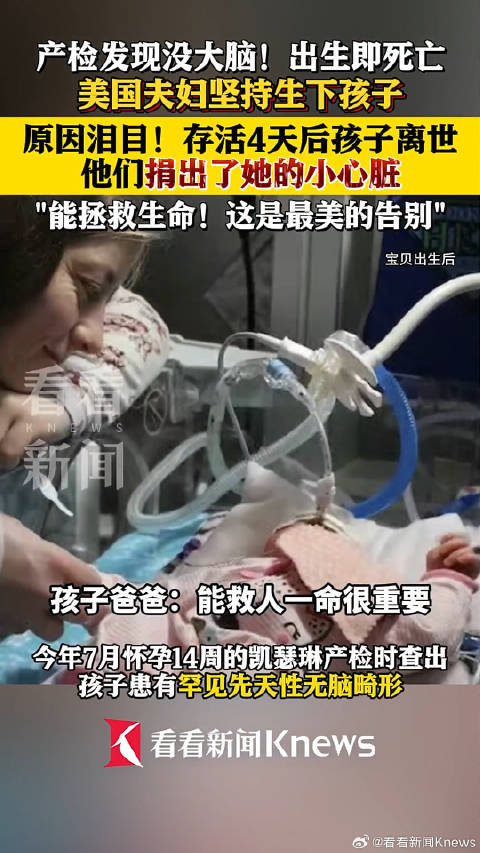 出生即死亡! 美国夫妇坚持生下无脑儿捐献器官