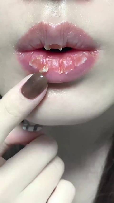 UNNY CLUB润唇膏解决撕嘴皮后干爆问题