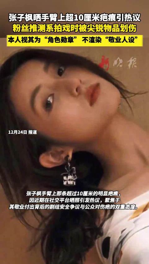 张子枫晒超10厘米伤疤，粉丝推测拍戏划伤