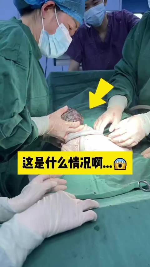 真悬乎！差一点就被自己“玩坏”，宝宝用脐带上演了终极缠绕！