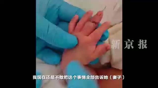 盱眙县卫健委已收到断指婴儿父亲鉴定材料