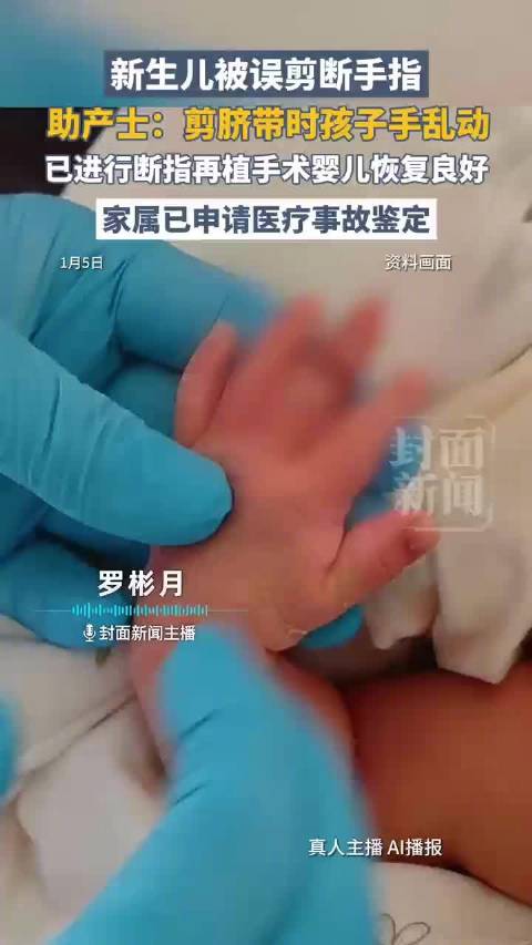 多方回应新生儿被剪断手指