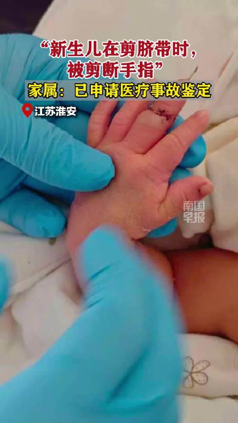 新生儿在剪脐带时被剪断手指，助产士称因“孩子的手突然乱动”