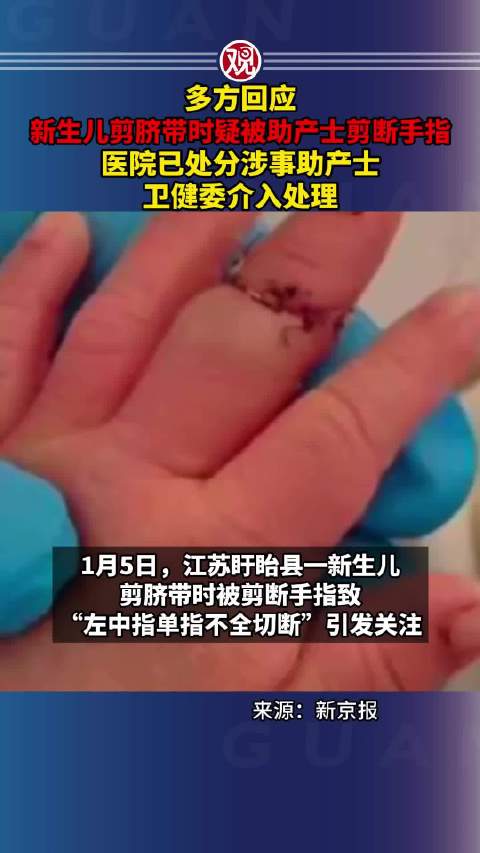 新生儿剪脐带时被剪断手指，医院处分助产士卫健委介入