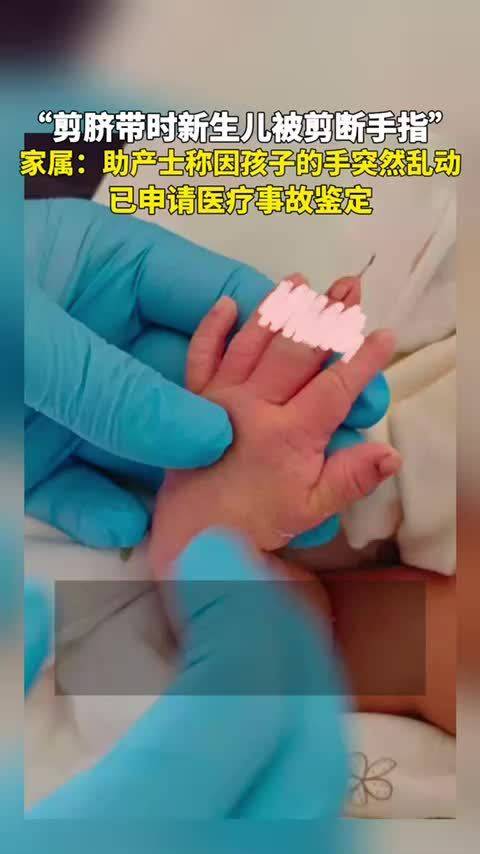 新生儿剪脐带时被剪断手指，家属称助产士归因孩子乱动