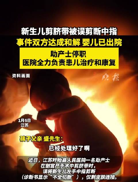 新生儿剪脐带误断中指，涉事助产士停职双方和解
