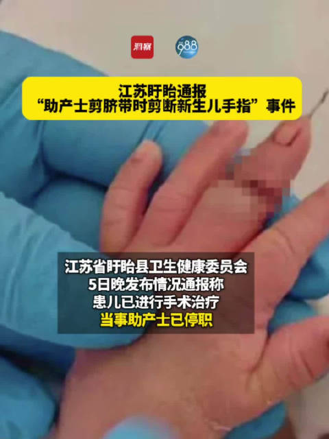 “助产士剪脐带时剪断新生儿手指”，最新通报