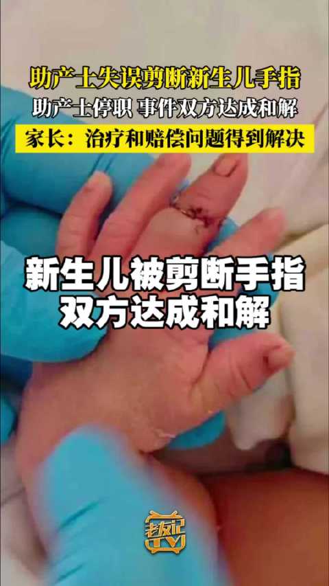 “助产士误剪新生儿手指”事件双方达成和解，患儿已出院