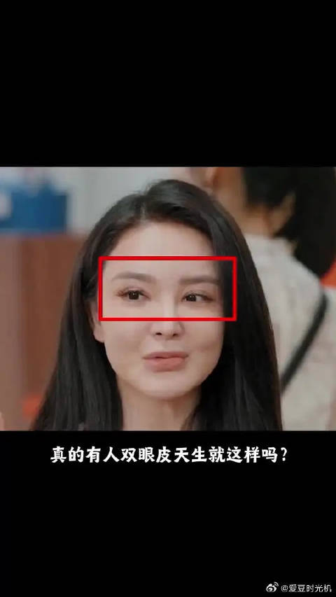 真的有人天生双眼皮就这样吗？