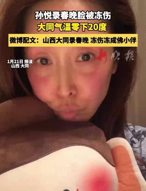 孙悦大同录春晚脸部冻伤，自嘲冻成佛小伴