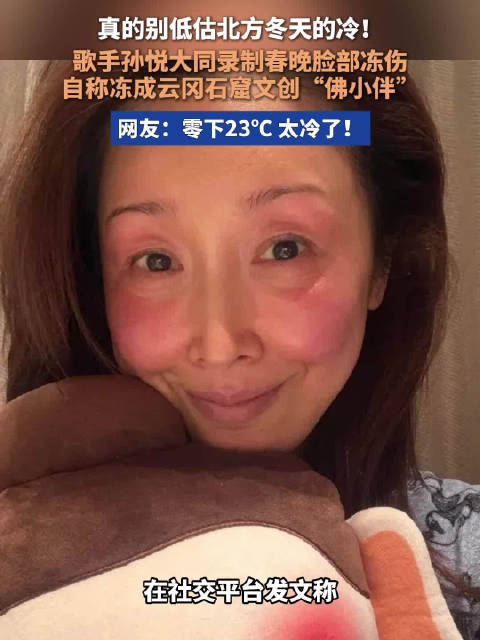 孙悦录春晚脸被冻伤