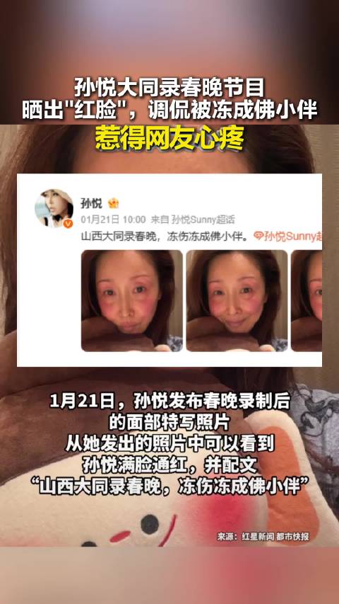 孙悦大同录春晚节目晒出"红脸"，调侃被冻伤冻成佛小伴！