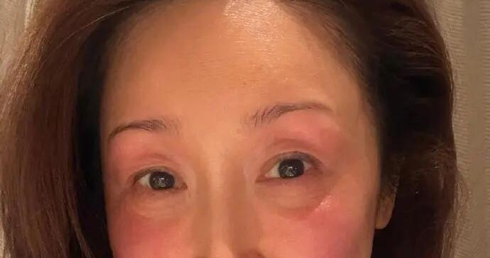 知名女歌手自曝：录春晚被冻伤！