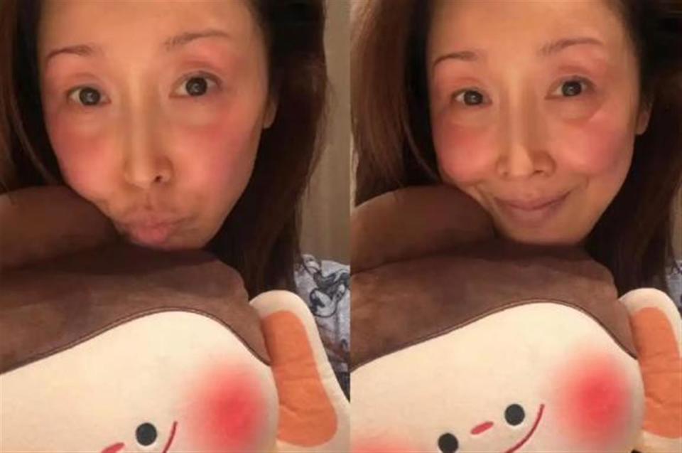 歌手孙悦自曝山西大同录春晚被冻伤，素颜照满脸通红！网友：-20℃，太冷了