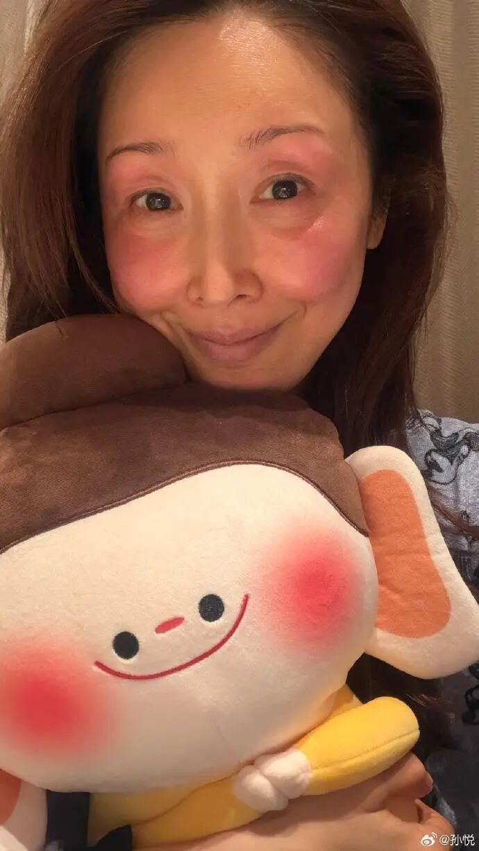 女歌手自曝录节目被冻伤，素颜照满脸通红，网友直呼心疼：零下20℃，太冷了_新闻