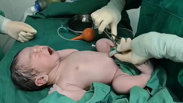 满足大家的好奇心，给大家看看，护士是怎么给宝宝剪脐带的！