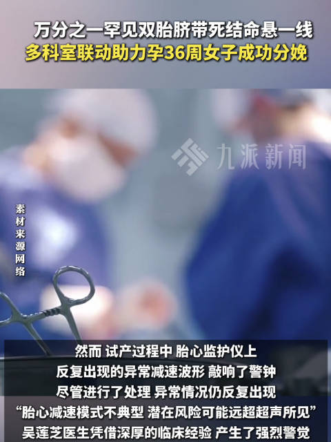 万分之一罕见双胎脐带打结惊心分娩