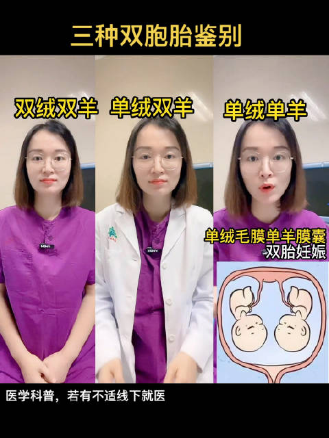 来看一下双绒双羊、单绒双羊、单绒单羊的区别吧